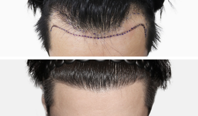 Patient results