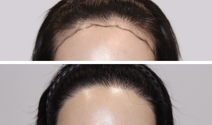 Patient results