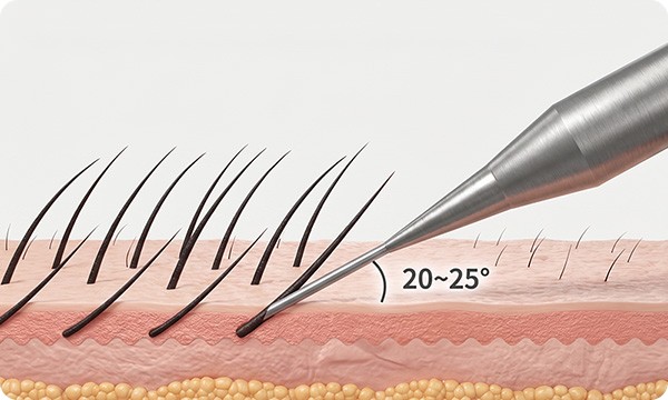 Implanted at an angle close to the skin