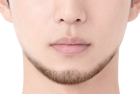 Chin beard only