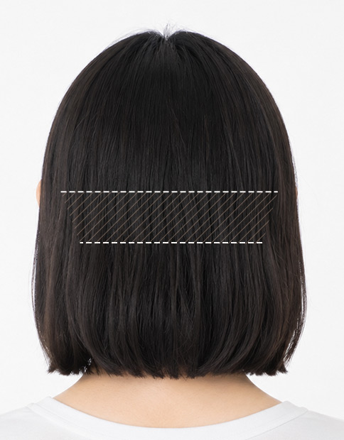 Straight-line incision