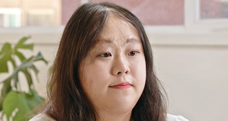 MOJELIM women's scar hair transplant