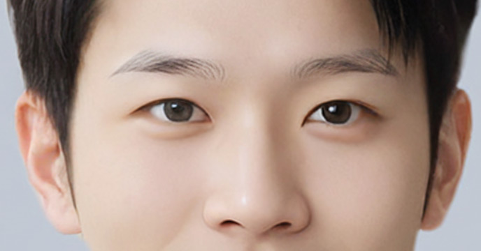 Who eyebrow transplantation is for